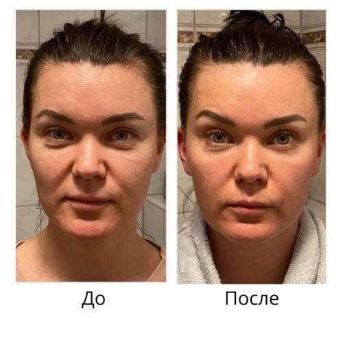 Результат до и после